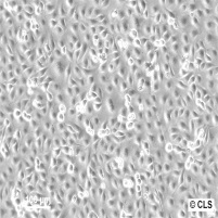 ECV-304细胞图片