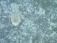MB49细胞图片