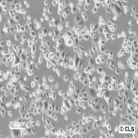 MX-1细胞图片