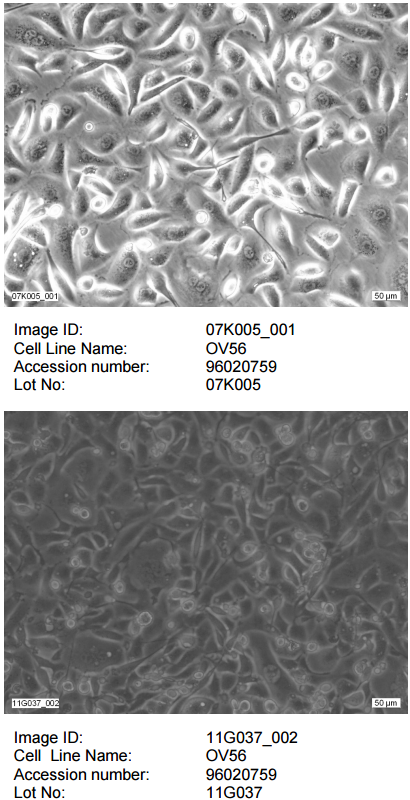 ATCC CCL-228 OV-56细胞图片