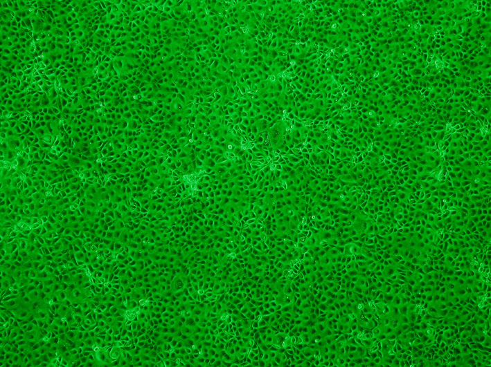 ATCC CCL-228 marc-145细胞图片