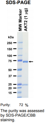 AKT2激酶蛋白