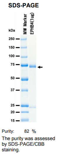 EPHB4激酶蛋白