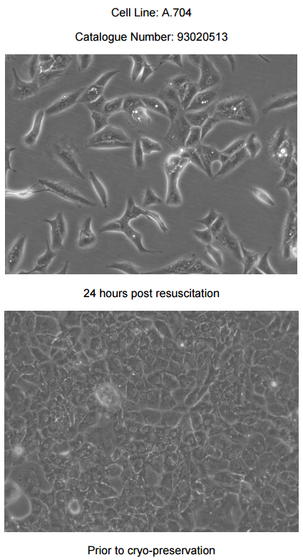 A-704细胞图片