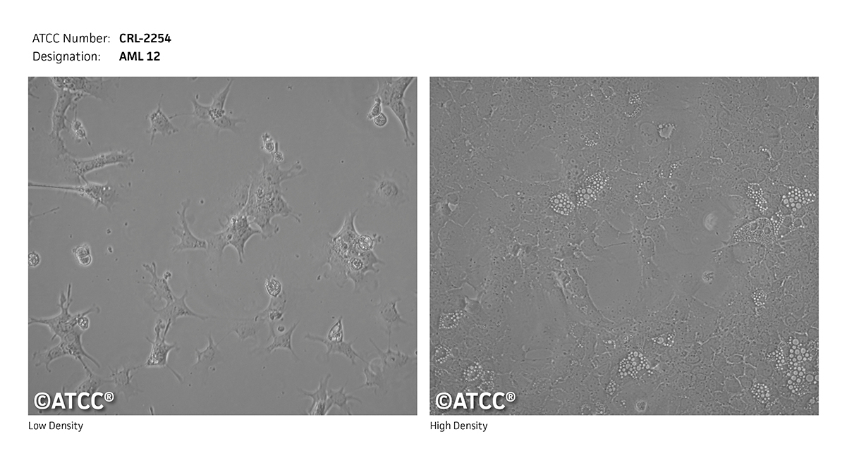 AML12细胞图片