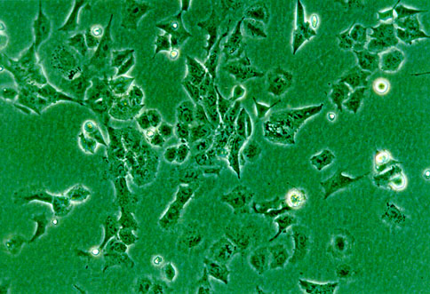 AZ-521细胞图片