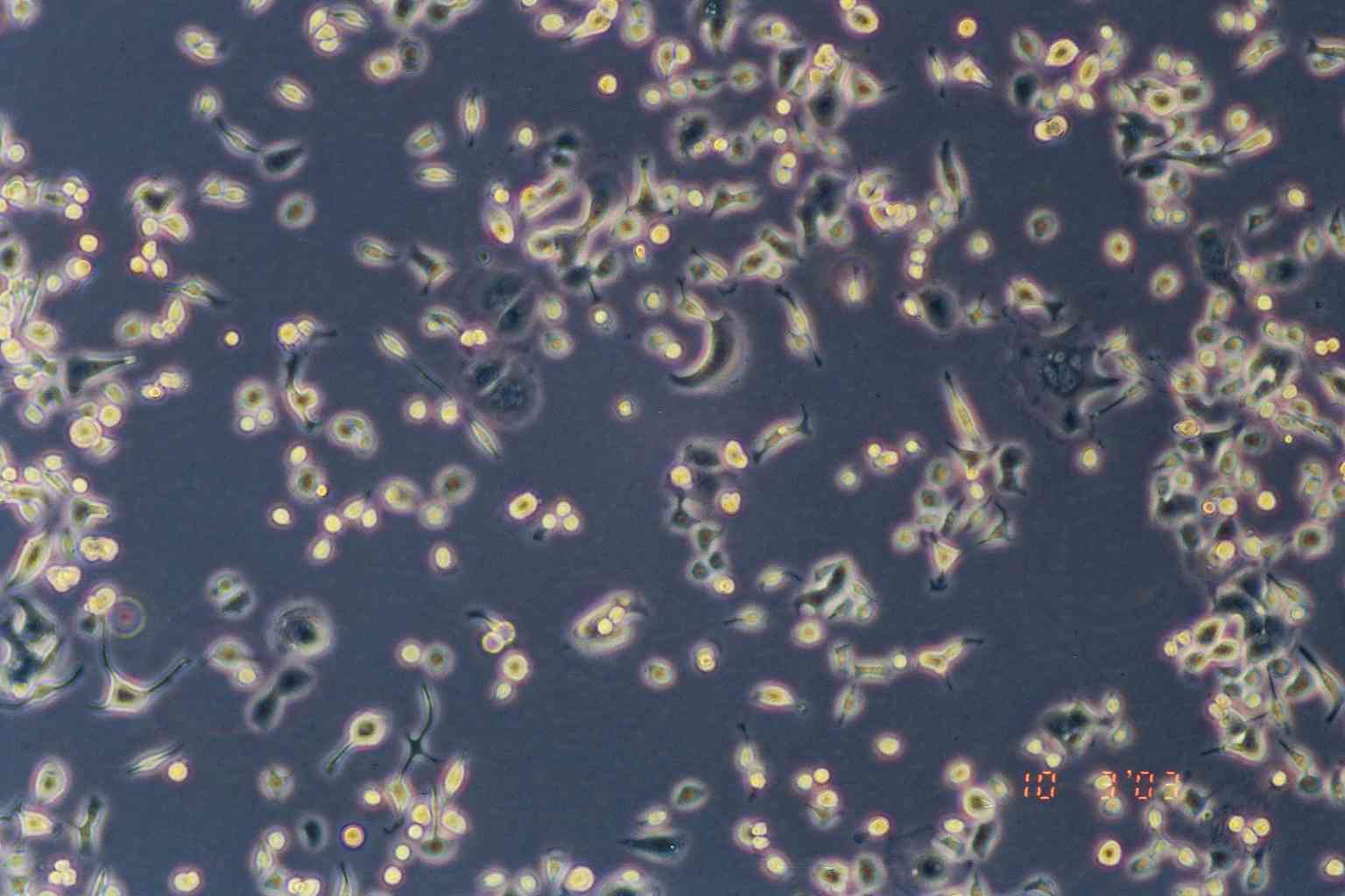 AsPC-1细胞图片