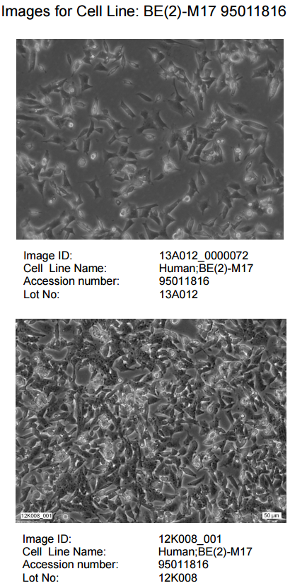 BE(2)-M17细胞图片