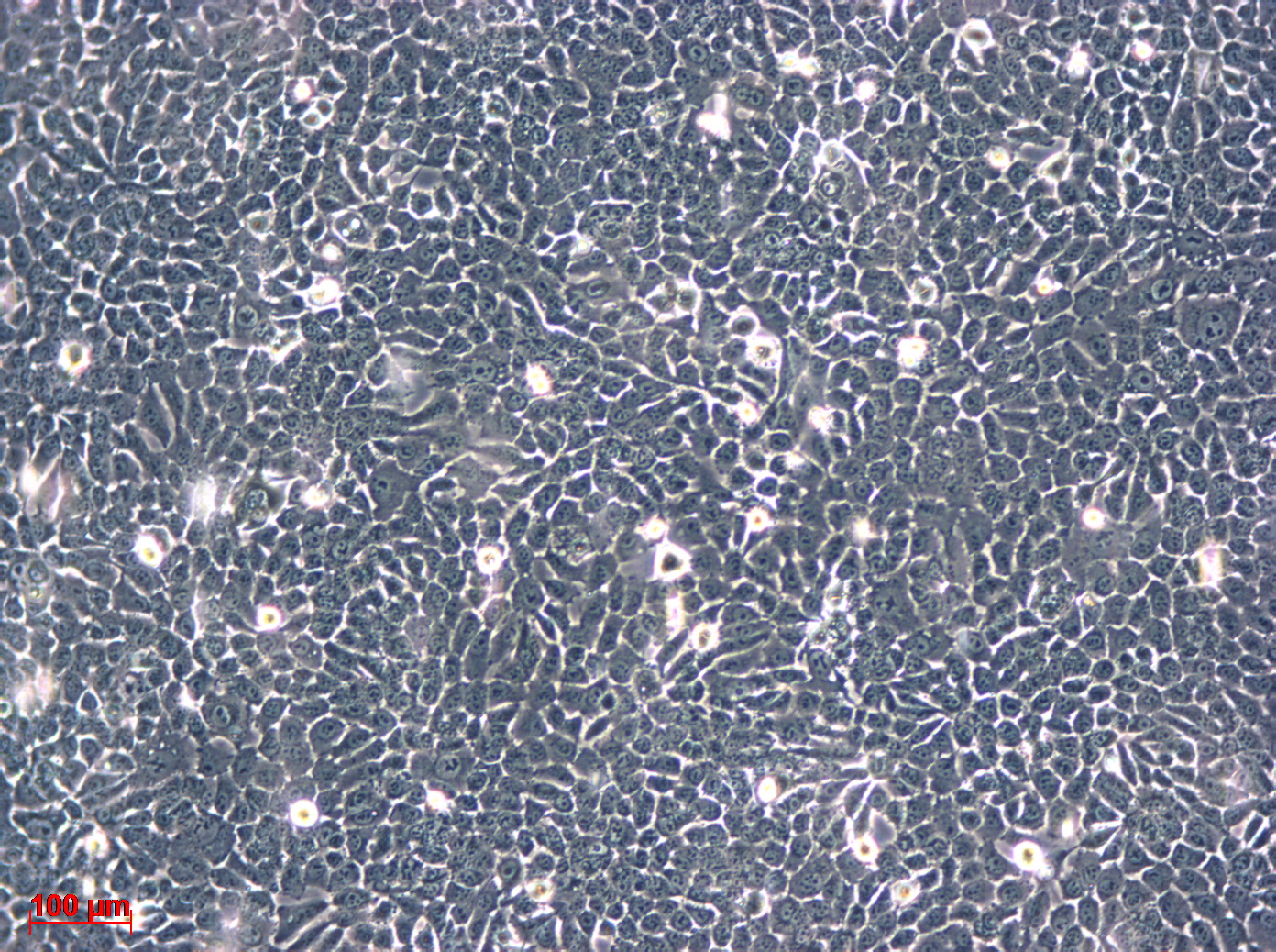 BFTC-905细胞图片