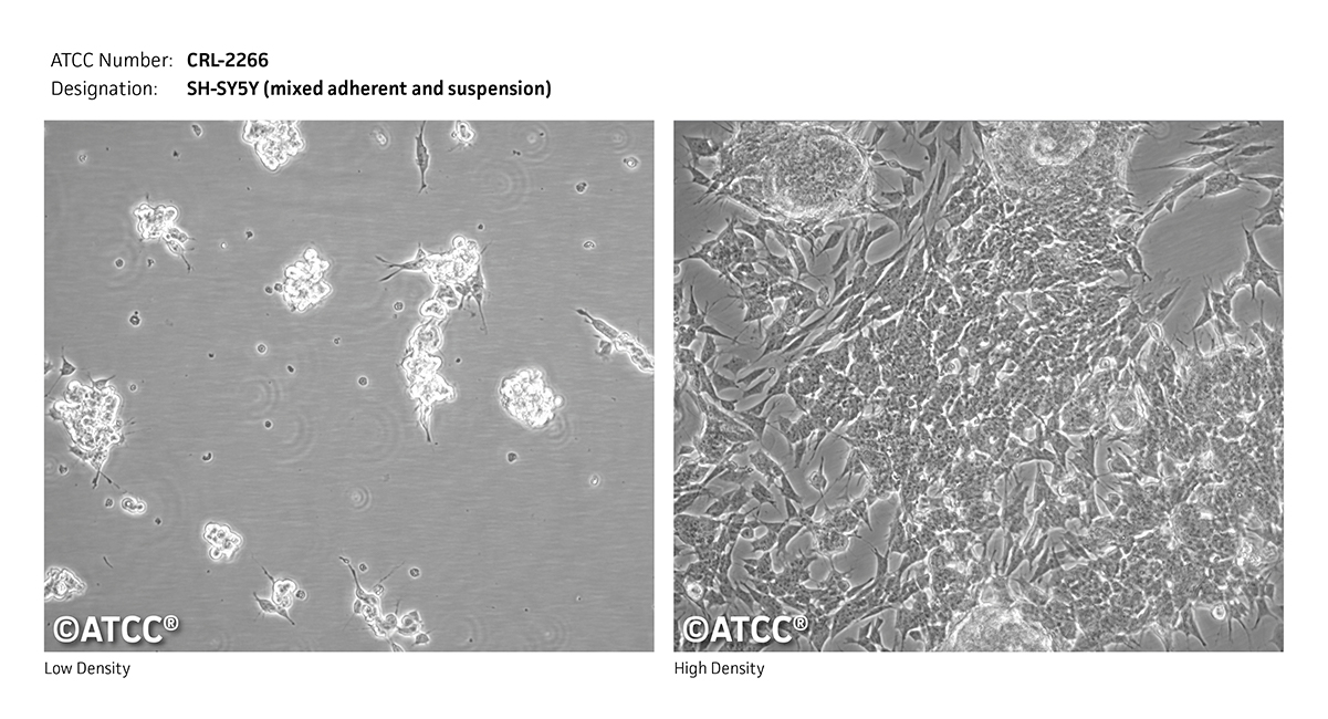 CAL-27细胞图片