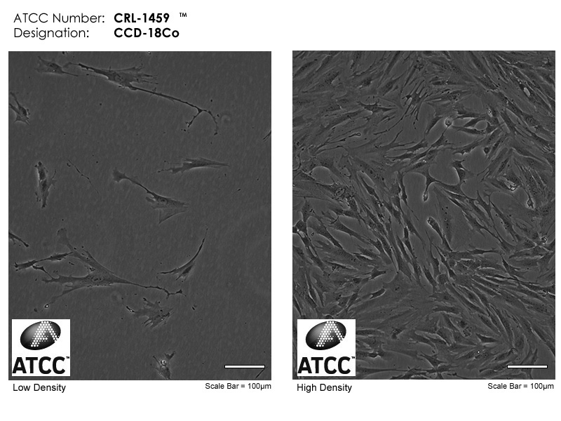 CCD-18Co细胞图片