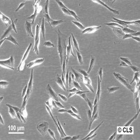 CCF-STTG1细胞图片