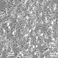 CCF-STTG1细胞图片