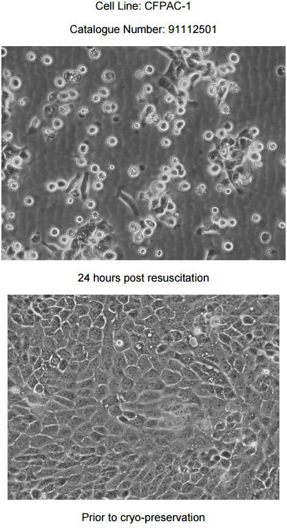 CFPAC-1细胞图片