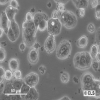 CX-1细胞图片
