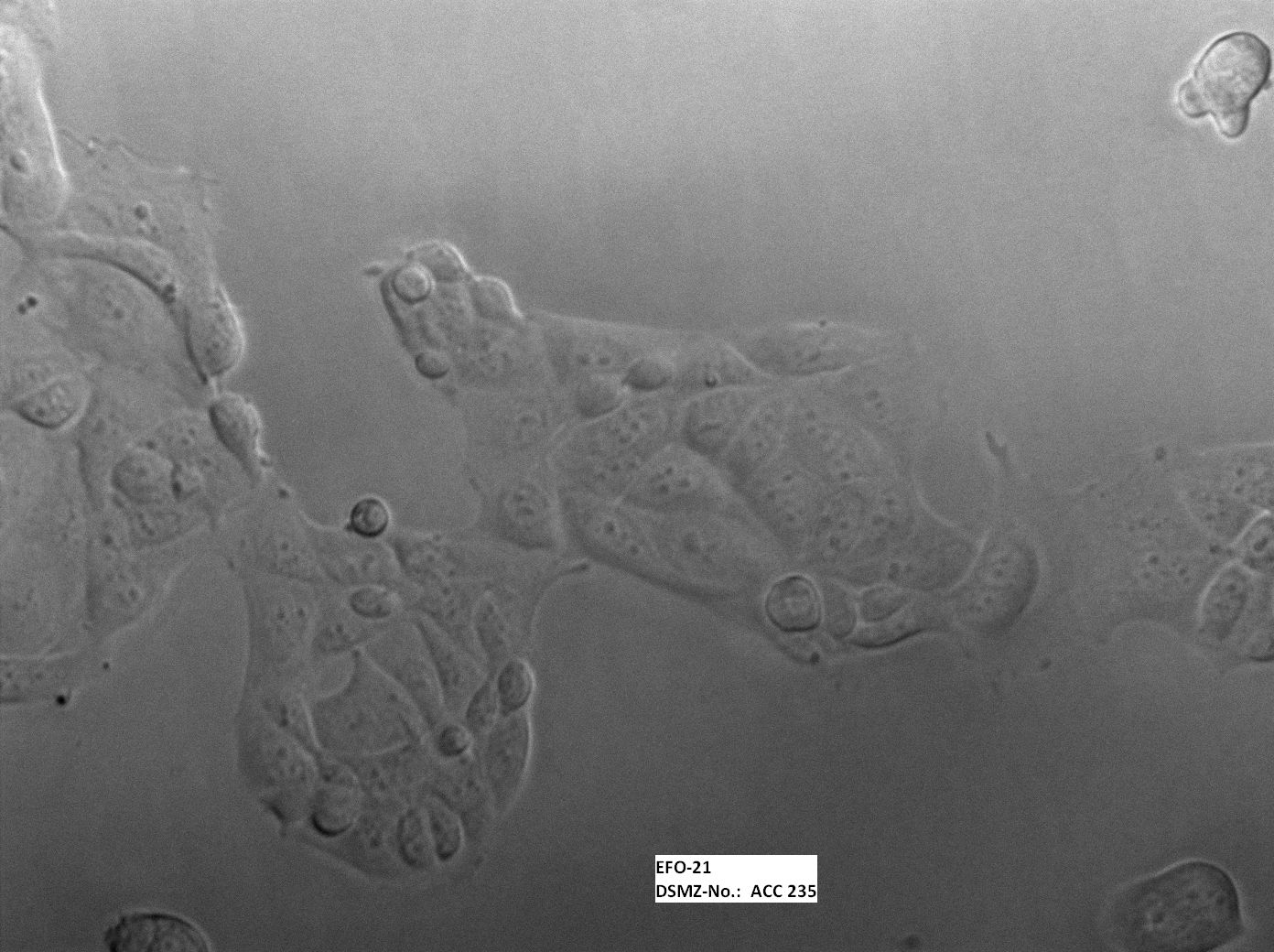 ATCC CCL-228 EFO-21细胞图片