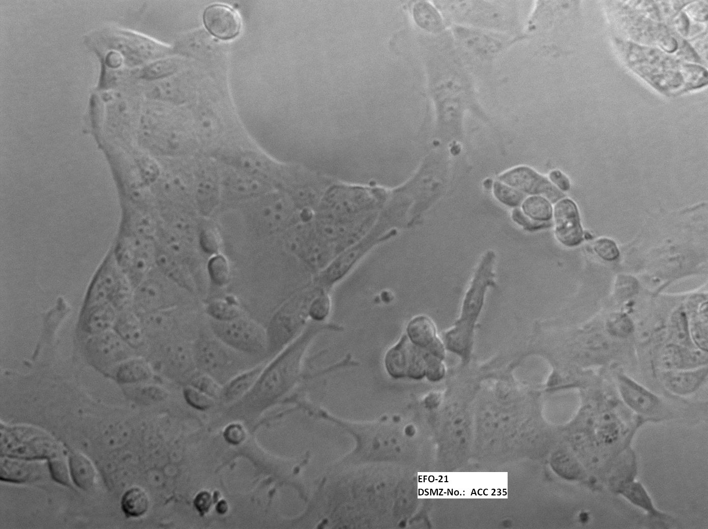 ATCC CCL-228 EFO-21细胞图片