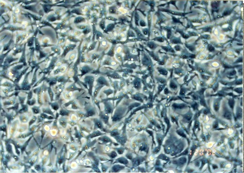 ES-2细胞图片