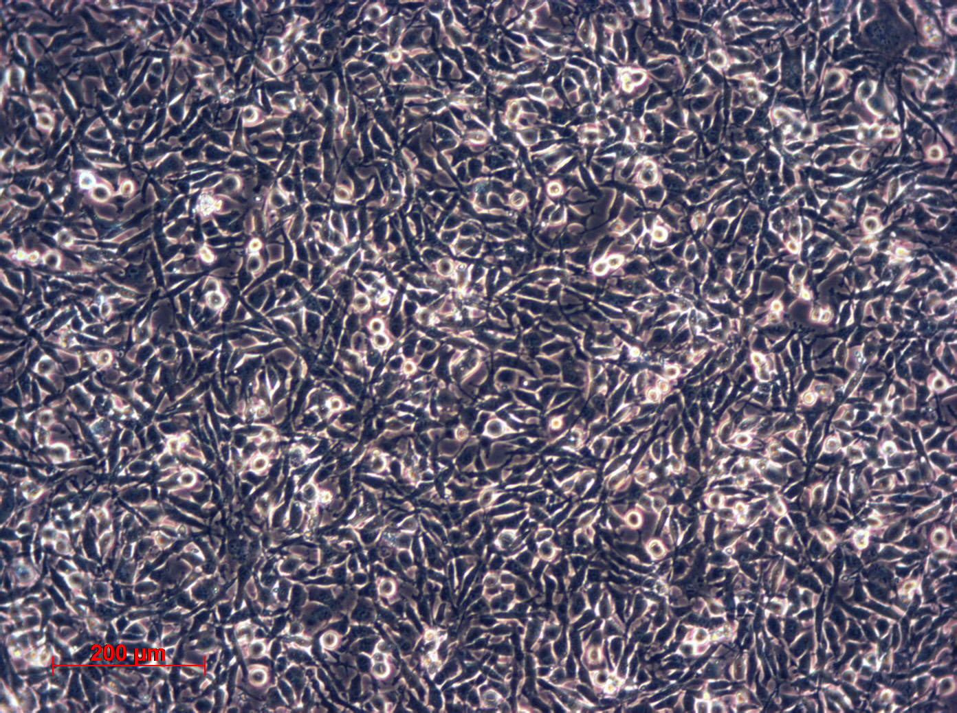 ES-2细胞图片