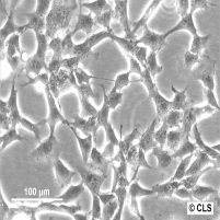 HBL-100细胞图片