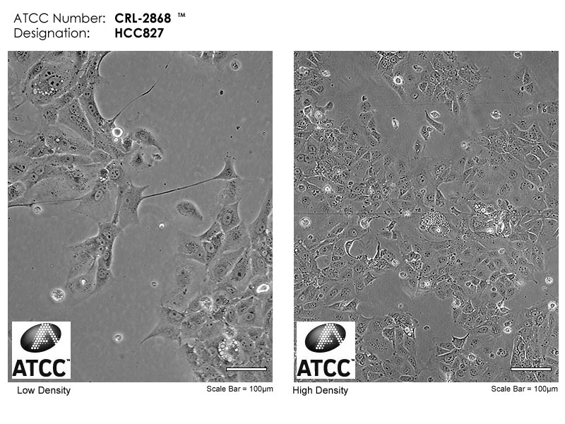HCC827细胞图片