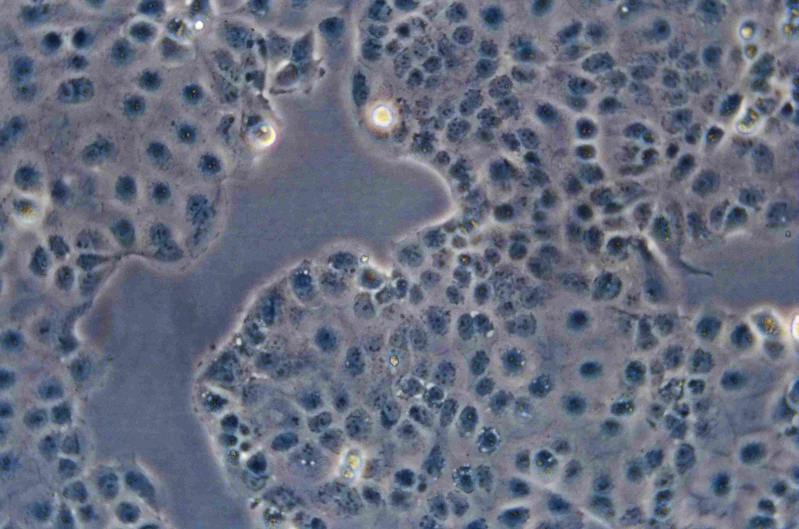 HEC-1-A细胞图片