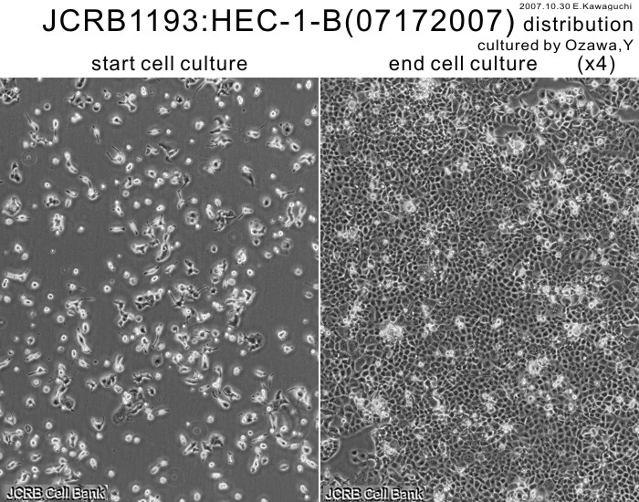 HEC-1-B细胞图片