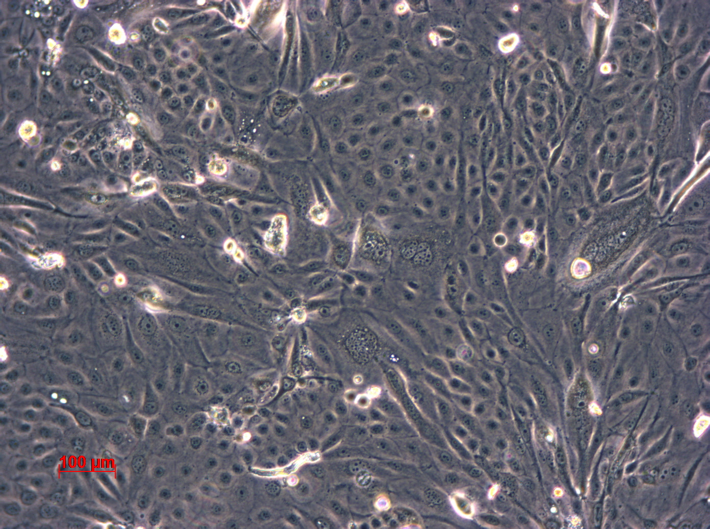 HT-1197细胞图片