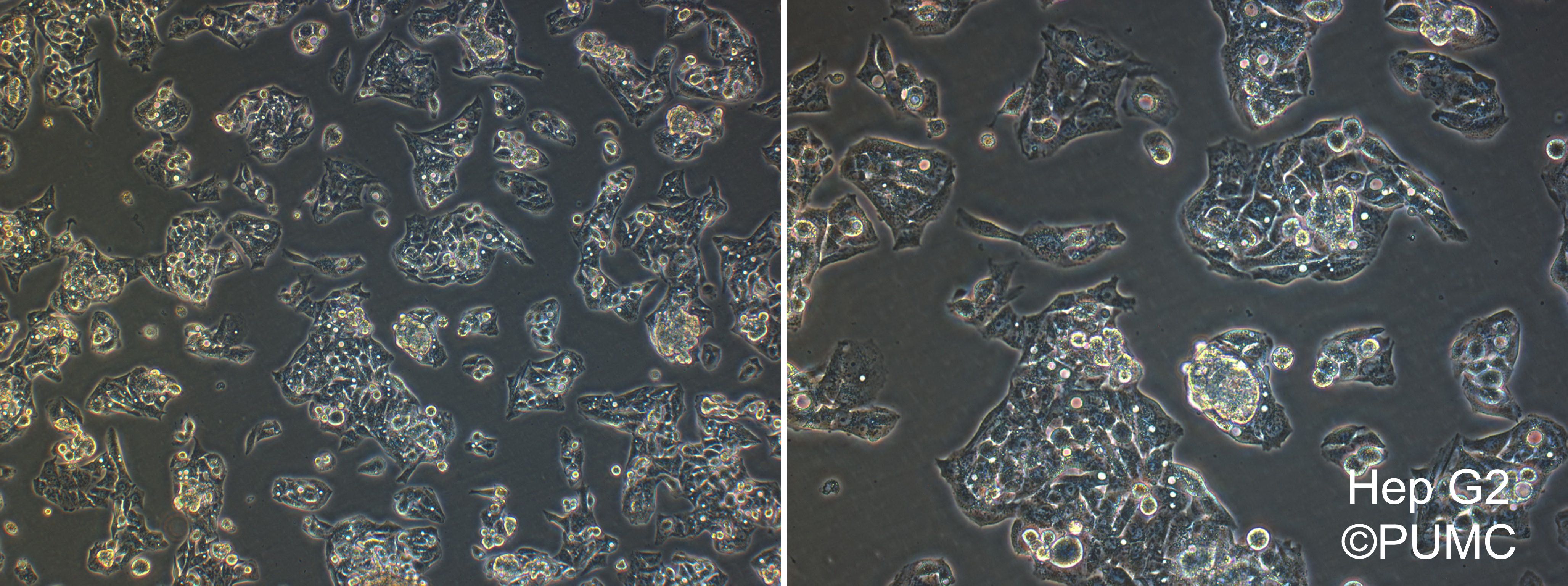 ATCC HB-8065(Hep G2)细胞图片