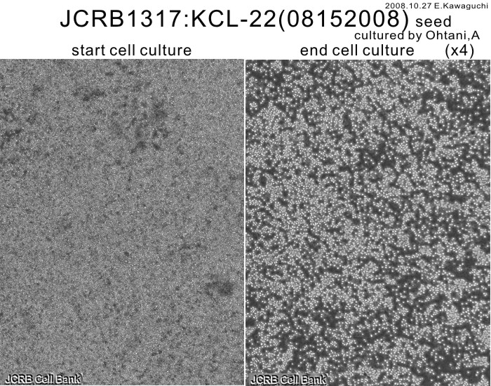 KCL-22细胞图片