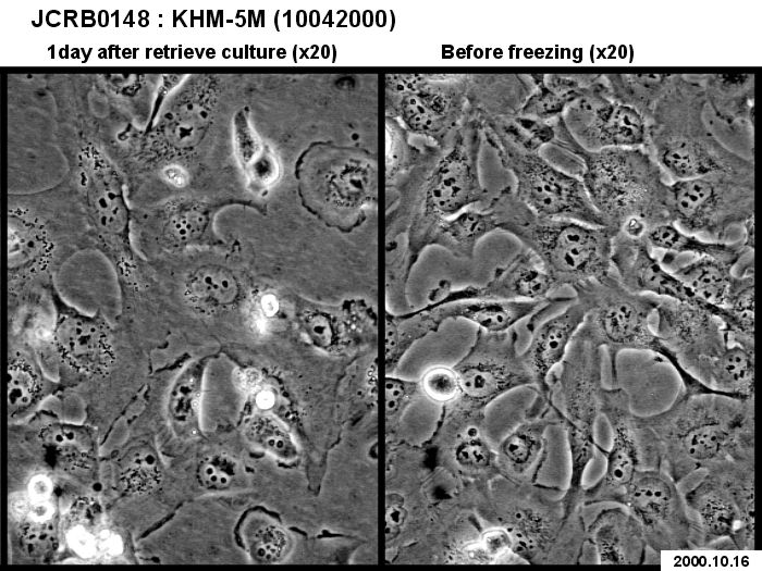 KHM-5M细胞图片