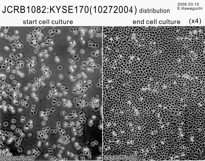 KYSE-170细胞图片