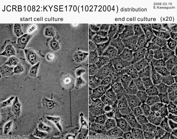 KYSE-170细胞图片