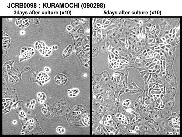 ATCC CCL-228 Kuramochi细胞图片