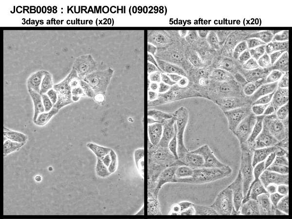ATCC CCL-228 Kuramochi细胞图片