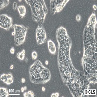 LCLC-97TM1细胞图片