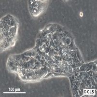 LCLC-97TM1细胞图片