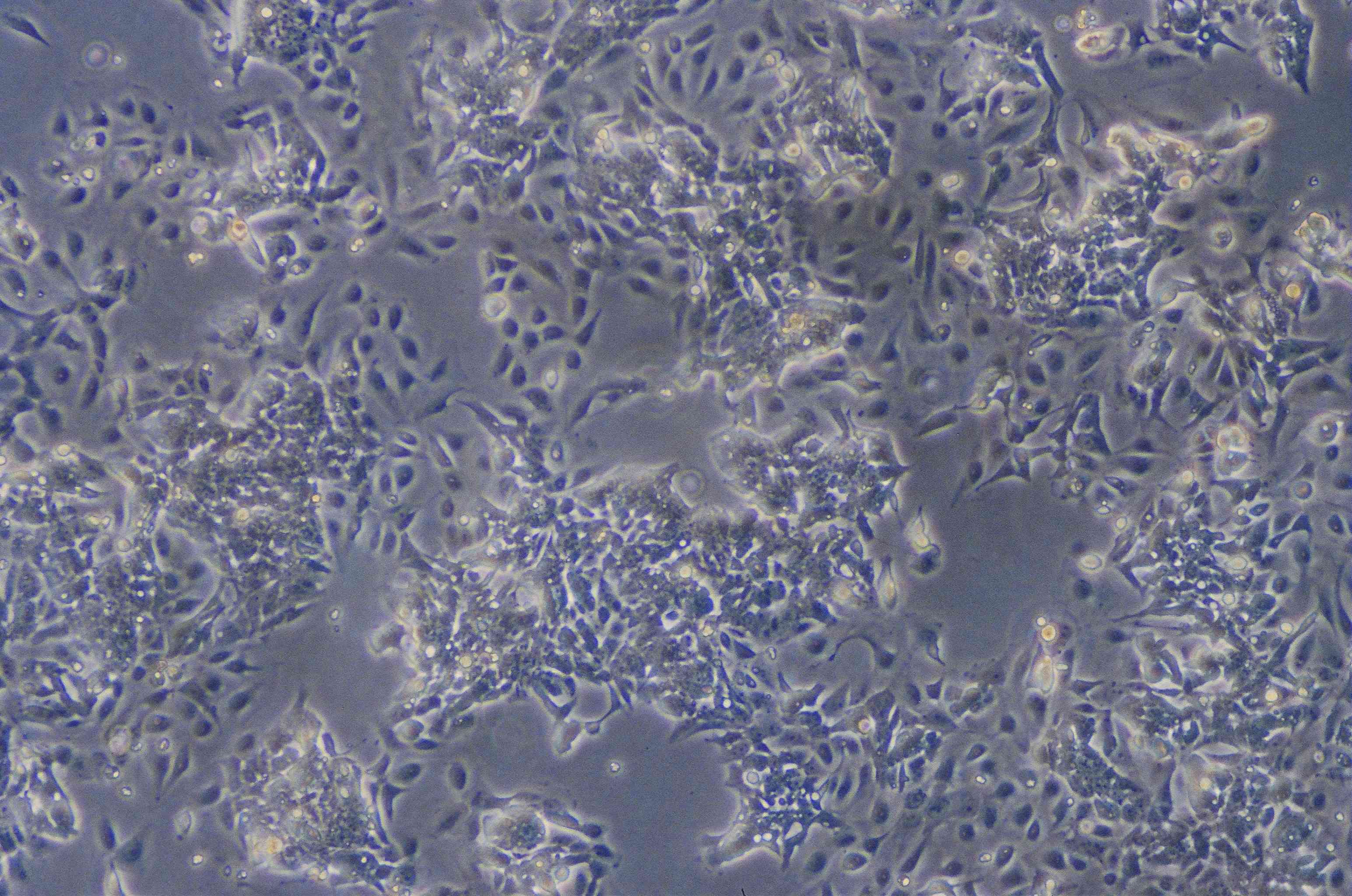 ATCC CCL-229 Lovo细胞图片