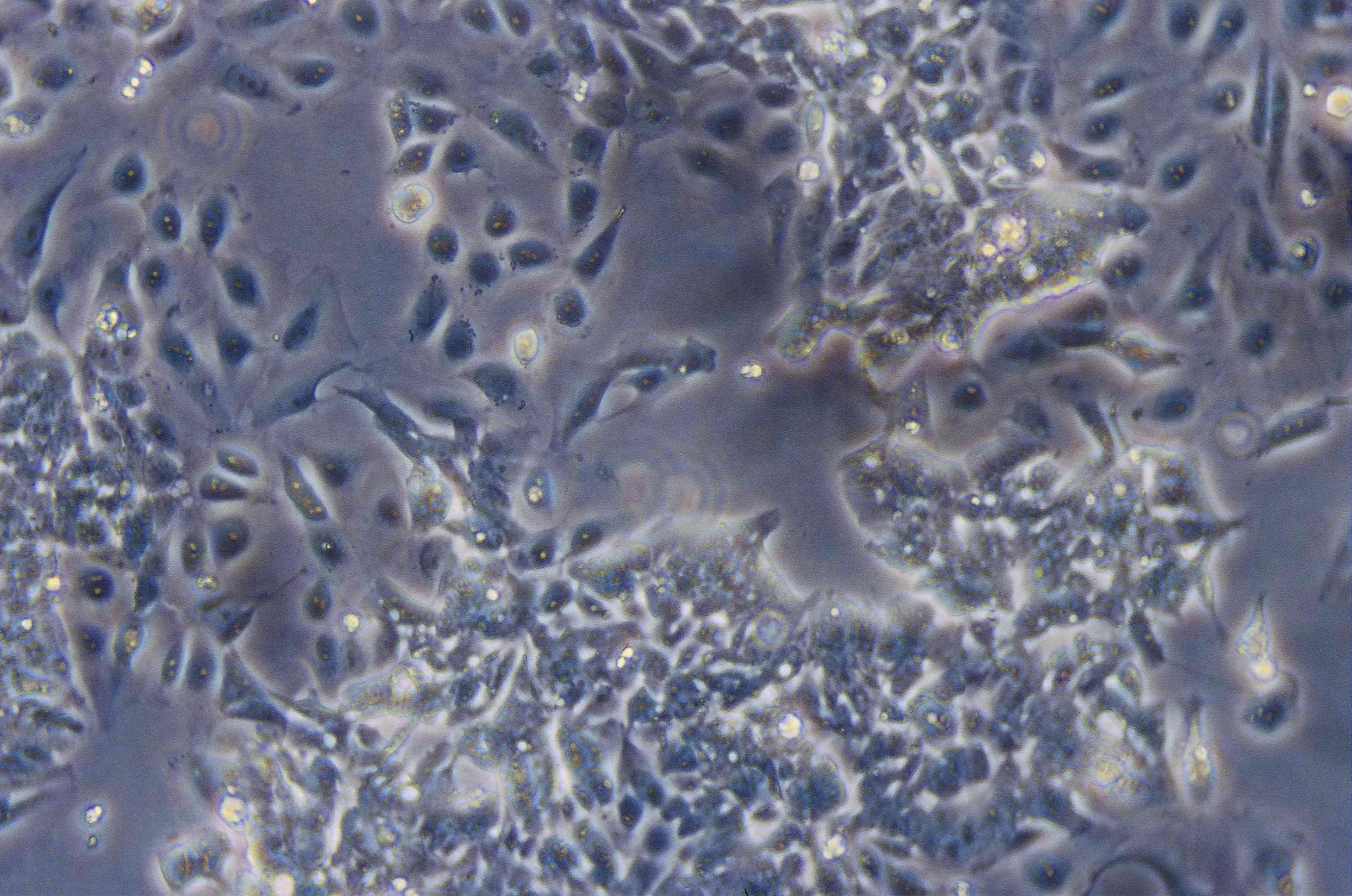 ATCC CCL-229 Lovo细胞图片