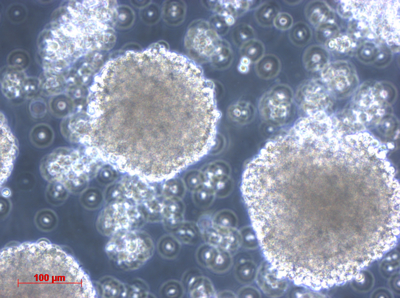 MC-116细胞图片
