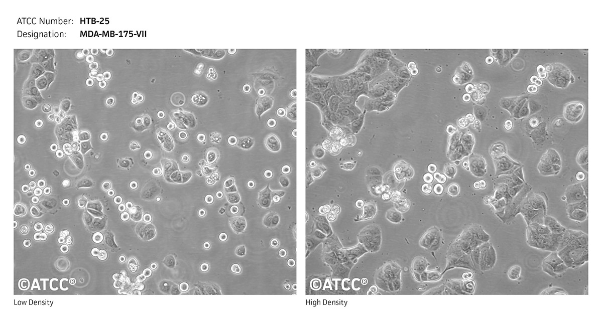 MDA-MB-175-VII细胞图片