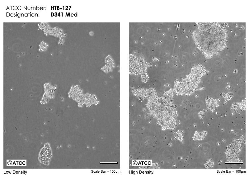 MDA-MB-330细胞图片