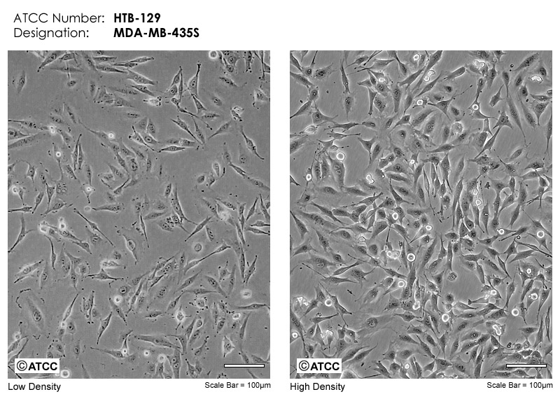 MDA-MB-435S细胞图片