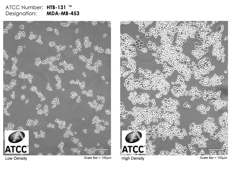 MDA-MB-453细胞图片