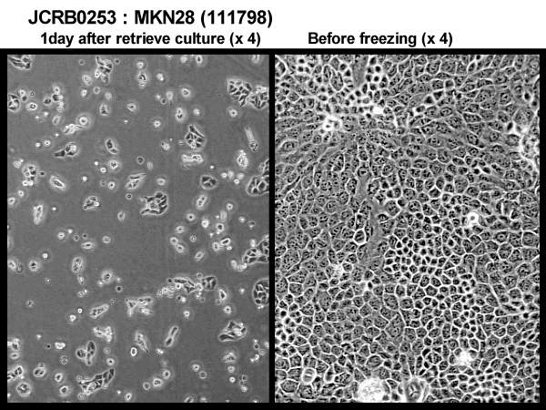 MKN-28细胞图片