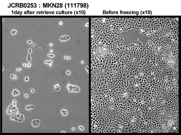 MKN-28细胞图片