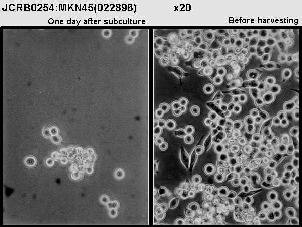MKN-45细胞图片