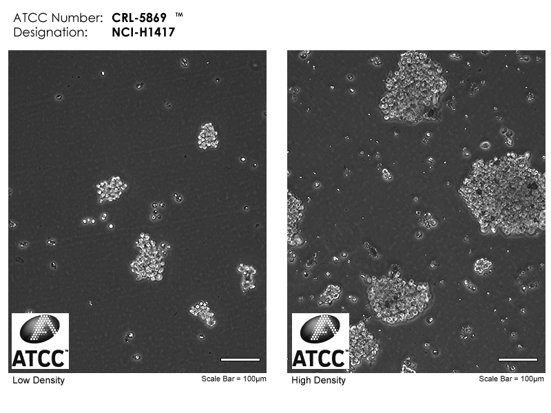 NCI-H1417细胞图片