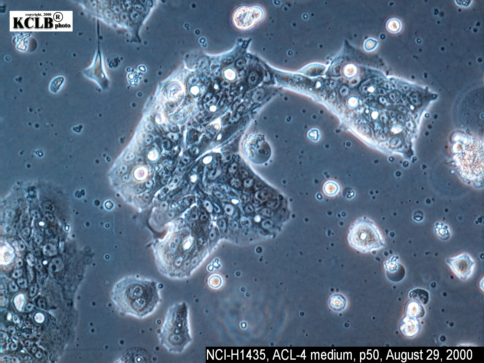 NCI-H1435细胞图片