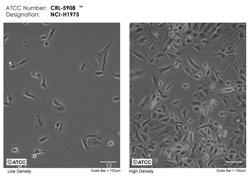 NCI-H1975细胞图片